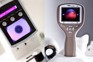 optical equipment, manufacturer, health medical operation,